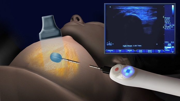 IceCure Medical ICE3